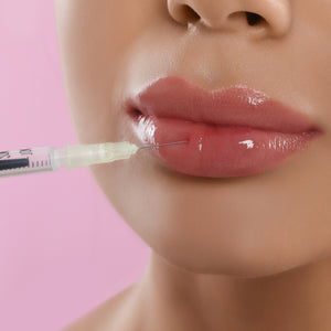 Lip filler injection