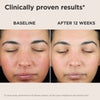 EltaMD UV Skin Recovery Green Tint Broad Spectrum SPF 50