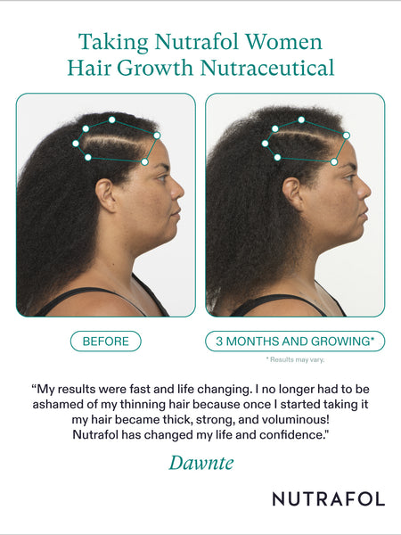 Nutrafol Women (90 Day Supply)