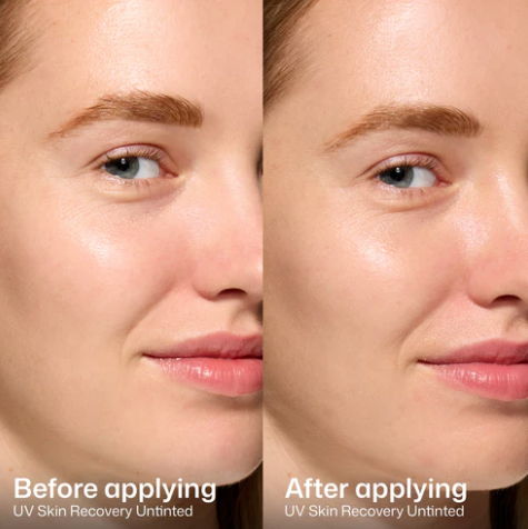 Elta MD- UV Skin Recovery SPF 50