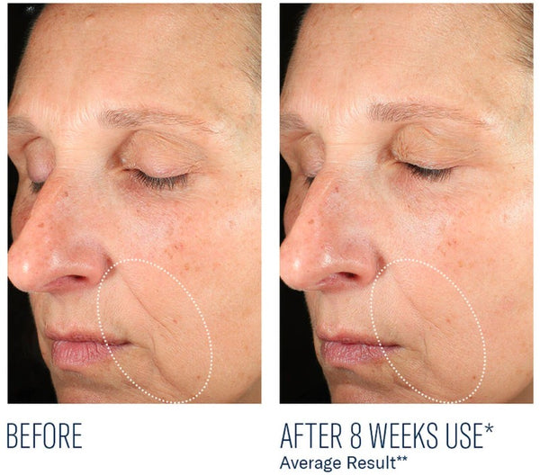 SkinBetter - Mystro Revive Renewing Serum